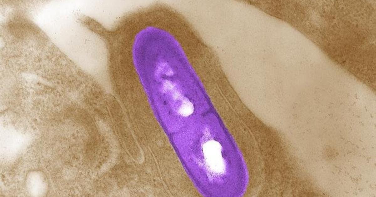 Deadly Listeria Outbreak on Dairy Products at Costco, Trader Joe's, and Walmart
